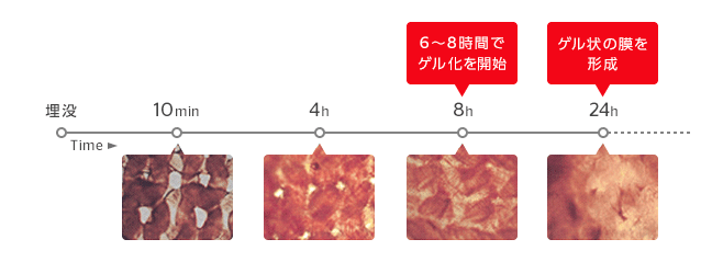 埋没後28日以内に加水分解され吸収されます。